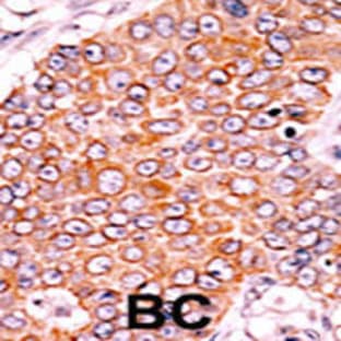 anti-Cyclin-Dependent Kinase Inhibitor 1B (p27, Kip1) (CDKN1B) (pSer10) antibody avatar