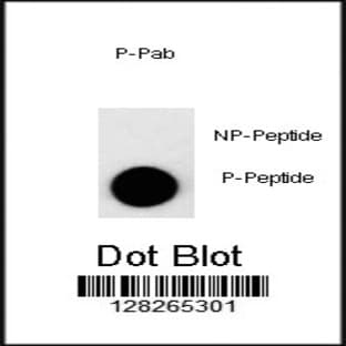 anti-Cyclin-Dependent Kinase Inhibitor 1B (p27, Kip1) (CDKN1B) (pThr157) antibody avatar