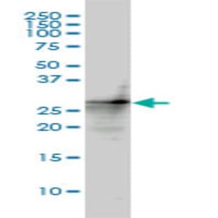 anti-Cyclin-Dependent Kinase Inhibitor 1B (p27, Kip1) (CDKN1B) (AA 1-199) antibody avatar
