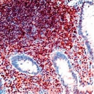 anti-Cyclin-Dependent Kinase Inhibitor 1B (p27, Kip1) (CDKN1B) antibody