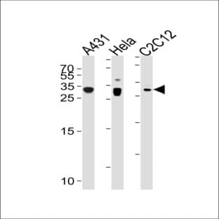 anti-Cyclin-Dependent Kinase Inhibitor 1B (p27, Kip1) (CDKN1B) (N-Term), (Ser12), (AA 1-30) antibody avatar