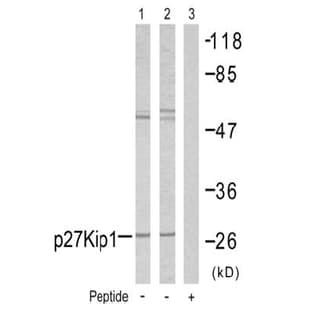 anti-Cyclin-Dependent Kinase Inhibitor 1B (p27, Kip1) (CDKN1B) (Ser10) antibody avatar