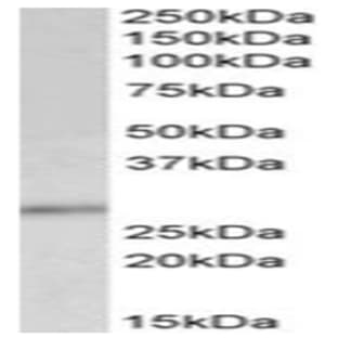anti-Cyclin-Dependent Kinase Inhibitor 1B (p27, Kip1) (CDKN1B) (C-Term) antibody avatar