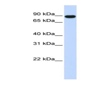 anti-A Kinase (PRKA) Anchor Protein 8 (AKAP8) (Middle Region) antibody avatar