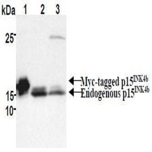 anti-Cyclin-Dependent Kinase Inhibitor 2B (p15, Inhibits CDK4) (CDKN2B) antibody avatar
