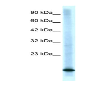 anti-Cyclin-Dependent Kinase Inhibitor 2B (p15, Inhibits CDK4) (CDKN2B) (Middle Region) antibody avatar