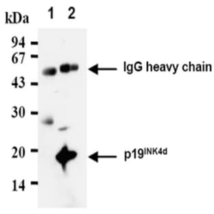 anti-Cyclin-Dependent Kinase Inhibitor 2D (p19, Inhibits CDK4) (CDKN2D) antibody avatar