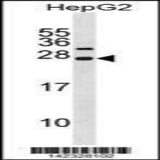 anti-Cyclin-Dependent Kinase Inhibitor 3 (CDKN3) (N-Term), (AA 39-68) antibody avatar