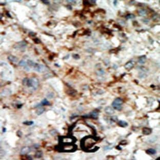 anti-Cyclin-Dependent Kinase Inhibitor 3 (CDKN3) (C-Term), (AA 183-212) antibody avatar