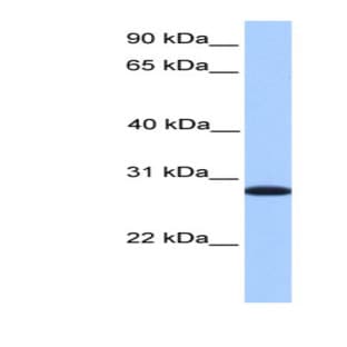 anti-Cyclin-Dependent Kinase Inhibitor 3 (CDKN3) (C-Term) antibody avatar