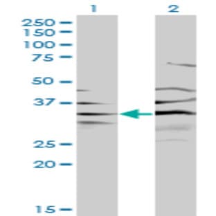 anti-3'(2'), 5'-Bisphosphate Nucleotidase 1 (BPNT1) (AA 1-101) antibody avatar