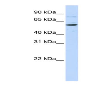 anti-CDP-Diacylglycerol Synthase (Phosphatidate Cytidylyltransferase) 1 (CDS1) (Middle Region) antibody avatar
