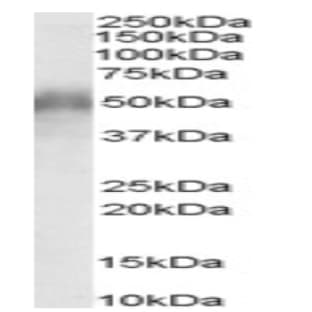 anti-CD2 (Cytoplasmic Tail) Binding Protein 2 (CD2BP2) (N-Term) antibody avatar