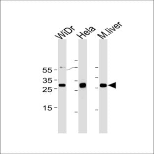 anti-Caudal Type Homeobox 1 (CDX1) (C-Term) antibody avatar