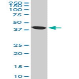anti-Acetyl-CoA Acyltransferase 2 (ACAA2) (AA 151-261) antibody avatar