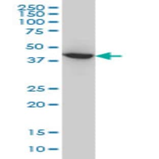 anti-Acetyl-CoA Acyltransferase 2 (ACAA2) (AA 151-261) antibody avatar