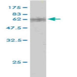 anti-Caudal Type Homeobox 2 (CDX2) (AA 1-313) antibody avatar