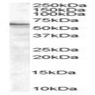 anti-BAI1-Associated Protein 2 (BAIAP2) (C-Term), (Isoform 2) antibody avatar