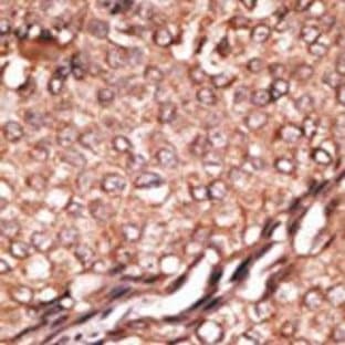 anti-BAI1-Associated Protein 2 (BAIAP2) (C-Term) antibody avatar