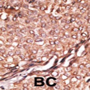 anti-BAI1-Associated Protein 2 (BAIAP2) (C-Term), (AA 492-518) antibody avatar
