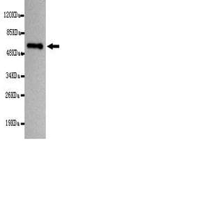 anti-Coactivator-Associated Arginine Methyltransferase 1 (CARM1) (C-Term) antibody avatar