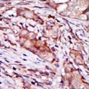 anti-CIB2 (N-Term) antibody avatar