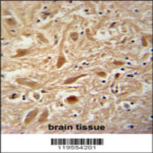 anti-Actin Related Protein 2/3 Complex, Subunit 1A, 41kDa (ARPC1A) (AA 157-184), (Center) antibody avatar