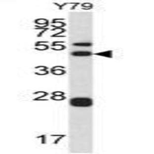 anti-Actin Related Protein 2/3 Complex, Subunit 1A, 41kDa (ARPC1A) (Middle Region) antibody avatar
