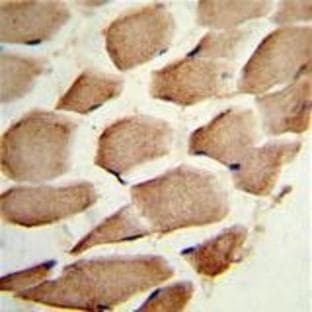 anti-Actin Related Protein 2/3 Complex, Subunit 1A, 41kDa (ARPC1A) (C-Term) antibody avatar