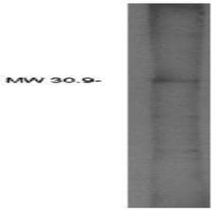 anti-1-Acylglycerol-3-Phosphate O-Acyltransferase 2 (Lysophosphatidic Acid Acyltransferase, Beta) (AGPAT2) antibody avatar