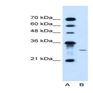 anti-1-Acylglycerol-3-Phosphate O-Acyltransferase 2 (Lysophosphatidic Acid Acyltransferase, Beta) (AGPAT2) (C-Term) antibody avatar