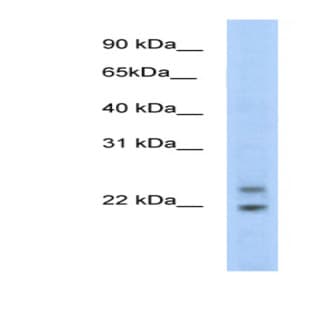 anti-Cytoplasmic Polyadenylated Homeobox (CPHX) (N-Term) antibody avatar