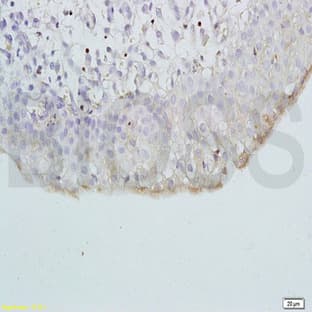 anti-Chemokine (C-X-C Motif) Ligand 13 (CXCL13) antibody avatar
