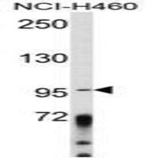 anti-A Kinase (PRKA) Anchor Protein 3 (AKAP3) (Middle Region) antibody avatar