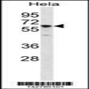 anti-Chaperonin Containing TCP1, Subunit 7 (Eta) (CCT7) (N-Term), (AA 64-92) antibody avatar