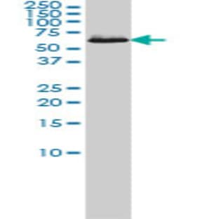 anti-Chaperonin Containing TCP1, Subunit 7 (Eta) (CCT7) (AA 425-528) antibody avatar