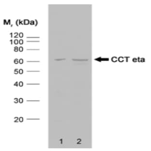 anti-Chaperonin Containing TCP1, Subunit 7 (Eta) (CCT7) antibody avatar