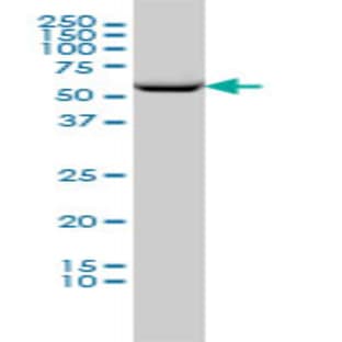 anti-Chaperonin Containing TCP1, Subunit 2 (Beta) (CCT2) (AA 117-218) antibody