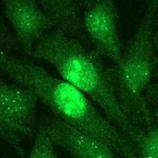 anti-Centromere Protein A (CENPA) (C-Term) antibody avatar