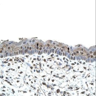 anti-Centromere Protein A (CENPA) (N-Term) antibody avatar