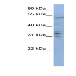 anti-Centromere Protein B (CENPB) (C-Term) antibody avatar