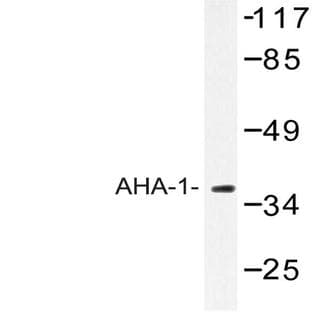 anti-AHA1, Activator of Heat Shock 90kDa Protein ATPase Homolog 1 (Yeast) (AHSA1) antibody avatar