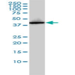 anti-AHA1, Activator of Heat Shock 90kDa Protein ATPase Homolog 1 (Yeast) (AHSA1) (AA 1-339) antibody avatar