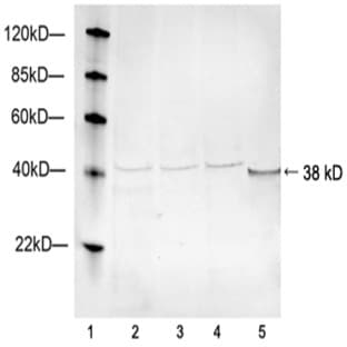 anti-AHA1, Activator of Heat Shock 90kDa Protein ATPase Homolog 1 (Yeast) (AHSA1) (AA 150-200) antibody avatar