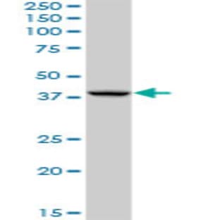 anti-AHA1, Activator of Heat Shock 90kDa Protein ATPase Homolog 1 (Yeast) (AHSA1) (AA 1-338) antibody avatar