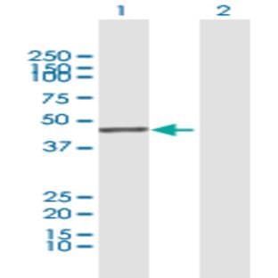 anti-AHA1, Activator of Heat Shock 90kDa Protein ATPase Homolog 1 (Yeast) (AHSA1) (AA 1-338) antibody avatar