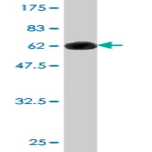 anti-AHA1, Activator of Heat Shock 90kDa Protein ATPase Homolog 1 (Yeast) (AHSA1) (AA 1-338) antibody avatar