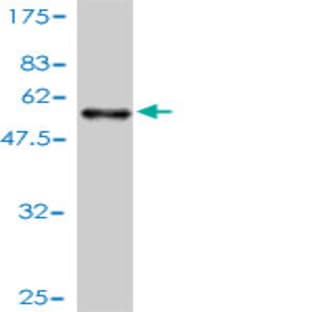 anti-AHA1, Activator of Heat Shock 90kDa Protein ATPase Homolog 1 (Yeast) (AHSA1) (AA 1-338) antibody avatar