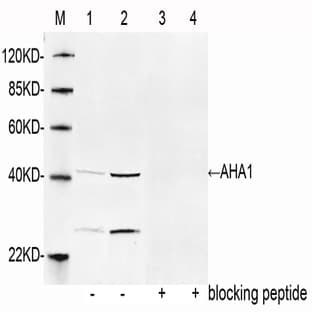 anti-AHA1, Activator of Heat Shock 90kDa Protein ATPase Homolog 1 (Yeast) (AHSA1) (AA 50-100) antibody avatar