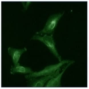 anti-AHA1, Activator of Heat Shock 90kDa Protein ATPase Homolog 1 (Yeast) (AHSA1) antibody avatar